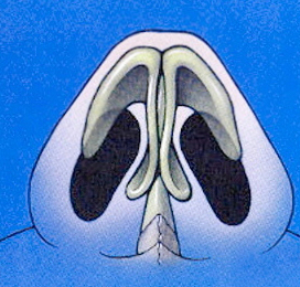 Ideal equilateral triangle of the nasal base